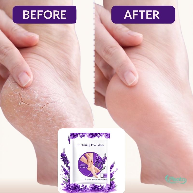 Exfoliating Foot Peel Mask