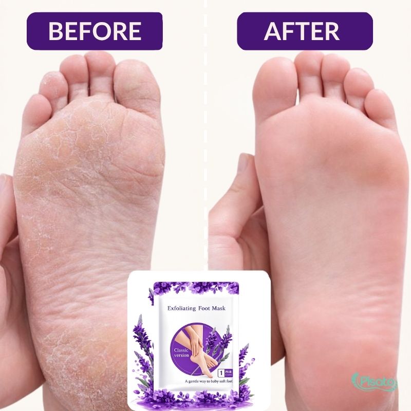 Exfoliating Foot Peel Mask