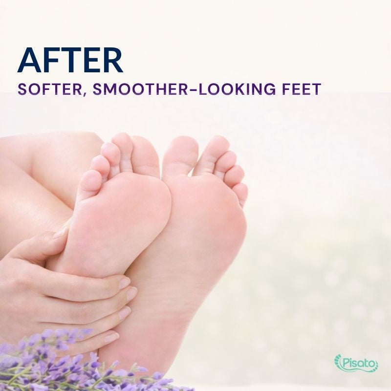 Exfoliating Foot Peel Mask