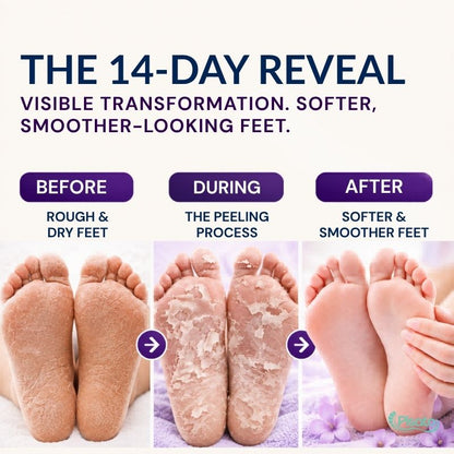 Exfoliating Foot Peel Mask