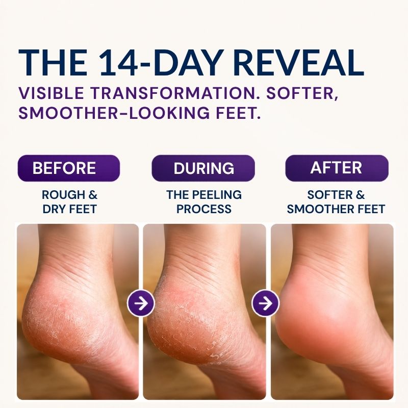 Exfoliating Foot Peel Mask