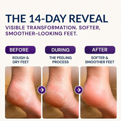 Exfoliating Foot Peel Mask