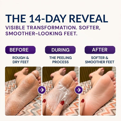 Exfoliating Foot Peel Mask